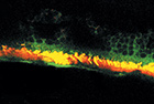 celule oculare cunoscute sub numele de celule epiteliale pigmentare retiniene