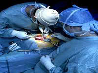 Bioetica: Transplantul de tesuturi si organe